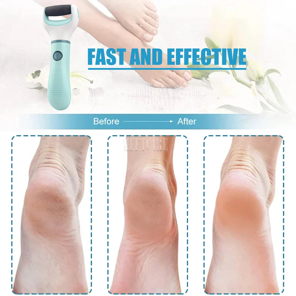 Râpe Électrique pour Pieds Sans Fil - Outil Pédicure Automatique pour Enlever la Peau Morte, Callosités, Fissures et Peau Durcie - Nettoyant de Pieds Étanche BLACKBEARD OUTDOOR INDUSTRIES