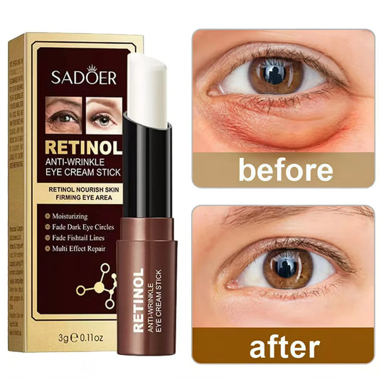 Crème Contour des Yeux Anti-Cernes et Anti-Rides | Hydratation et Éclaircissement des Cernes et Poches - BLACKBEARD OUTDOOR INDUSTRIES