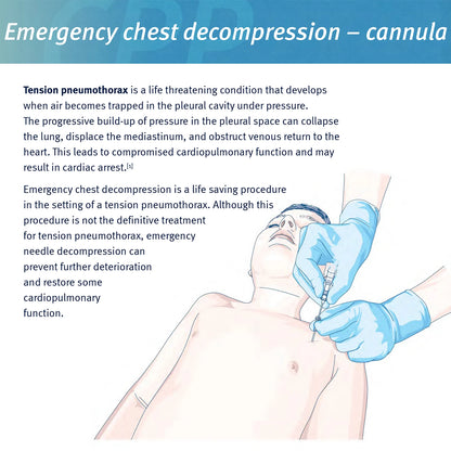 Kit Médical de Décompression pour Pneumothorax avec Aiguille Sanke - 14ga 50g - Catheter de Décompression d'Urgence (IFAK) - BLACKBEARD OUTDOOR INDUSTRIES